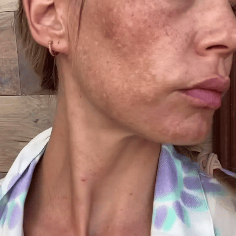 Eelhoe Retinol | Crema Blanqueadora Natural