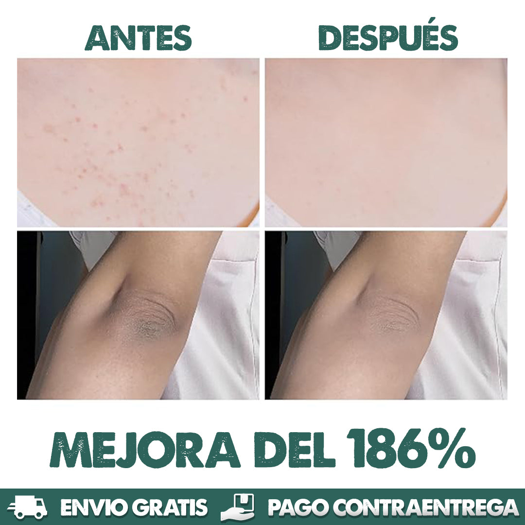 DR. MELAXIN - Aclara y unifíca el tono