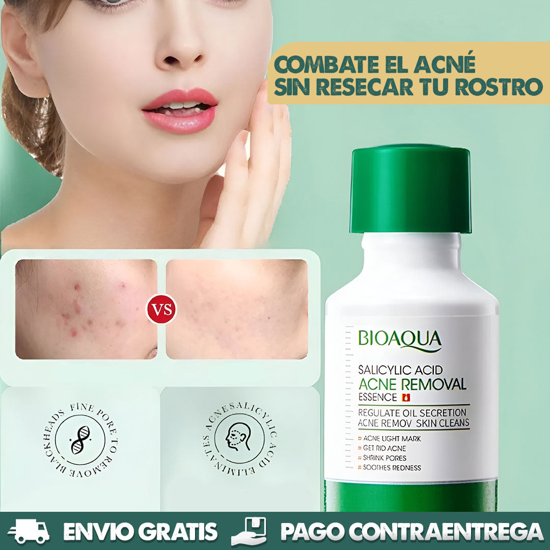 Acido Salicilico Bioaqua | Dile adiós al acné!