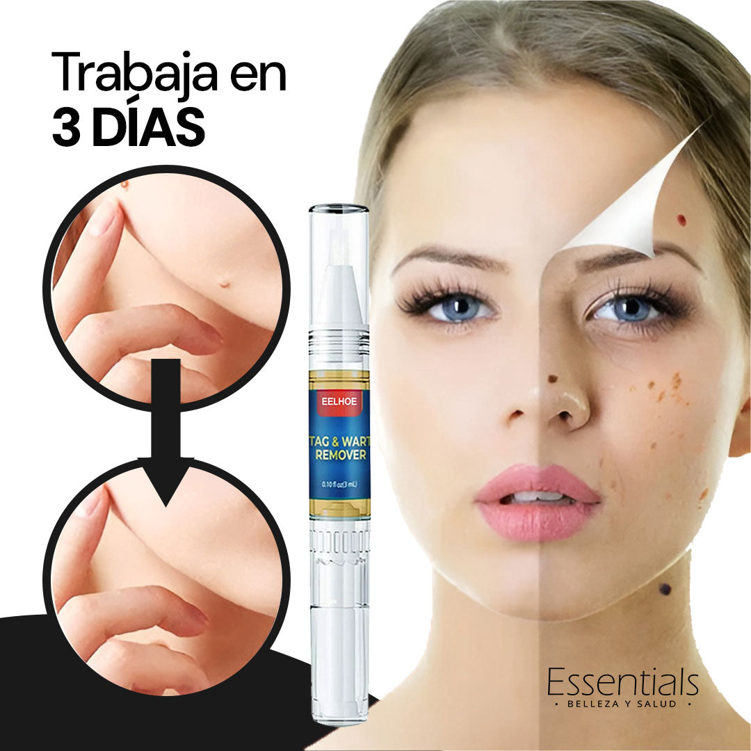 ¡ELIMINA VERRUGAS RÁPIDO Y SIN DOLOR! | Lápiz Removedor Profesional X2 unidades