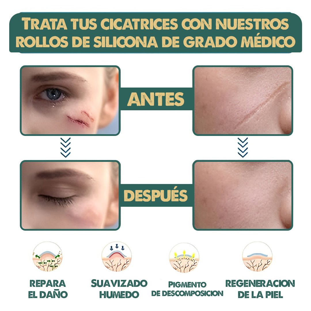 Silicone Scars Sheets | Adiós cicatrices y líneas de expresión desde la primera semana