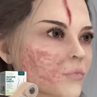 Silicone Scars Sheets | Adiós cicatrices y líneas de expresión desde la primera semana