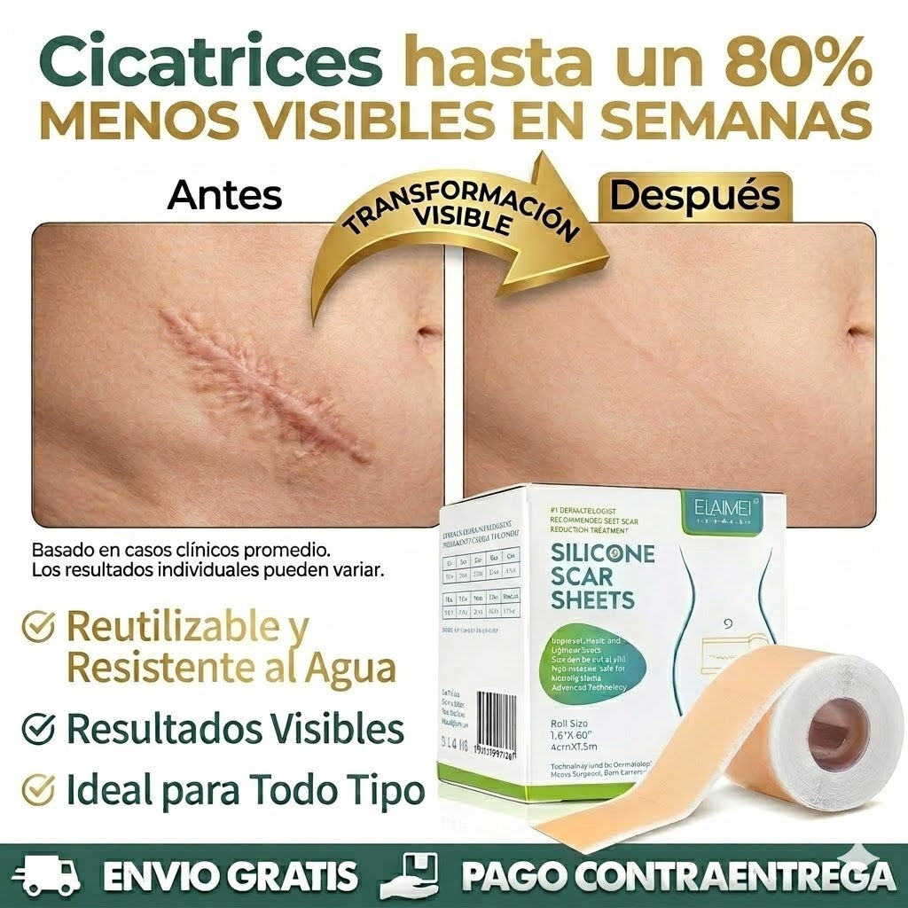Silicone Scars Sheets | Adiós cicatrices y líneas de expresión desde la primera semana