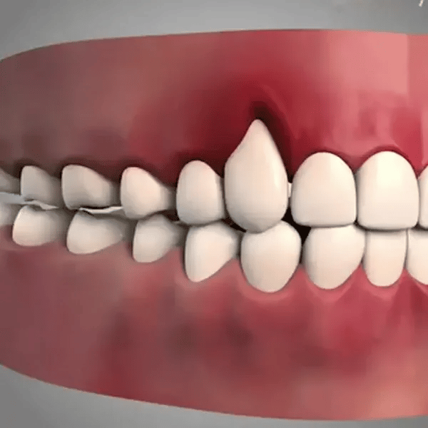 Persona con dientes amarillos triste