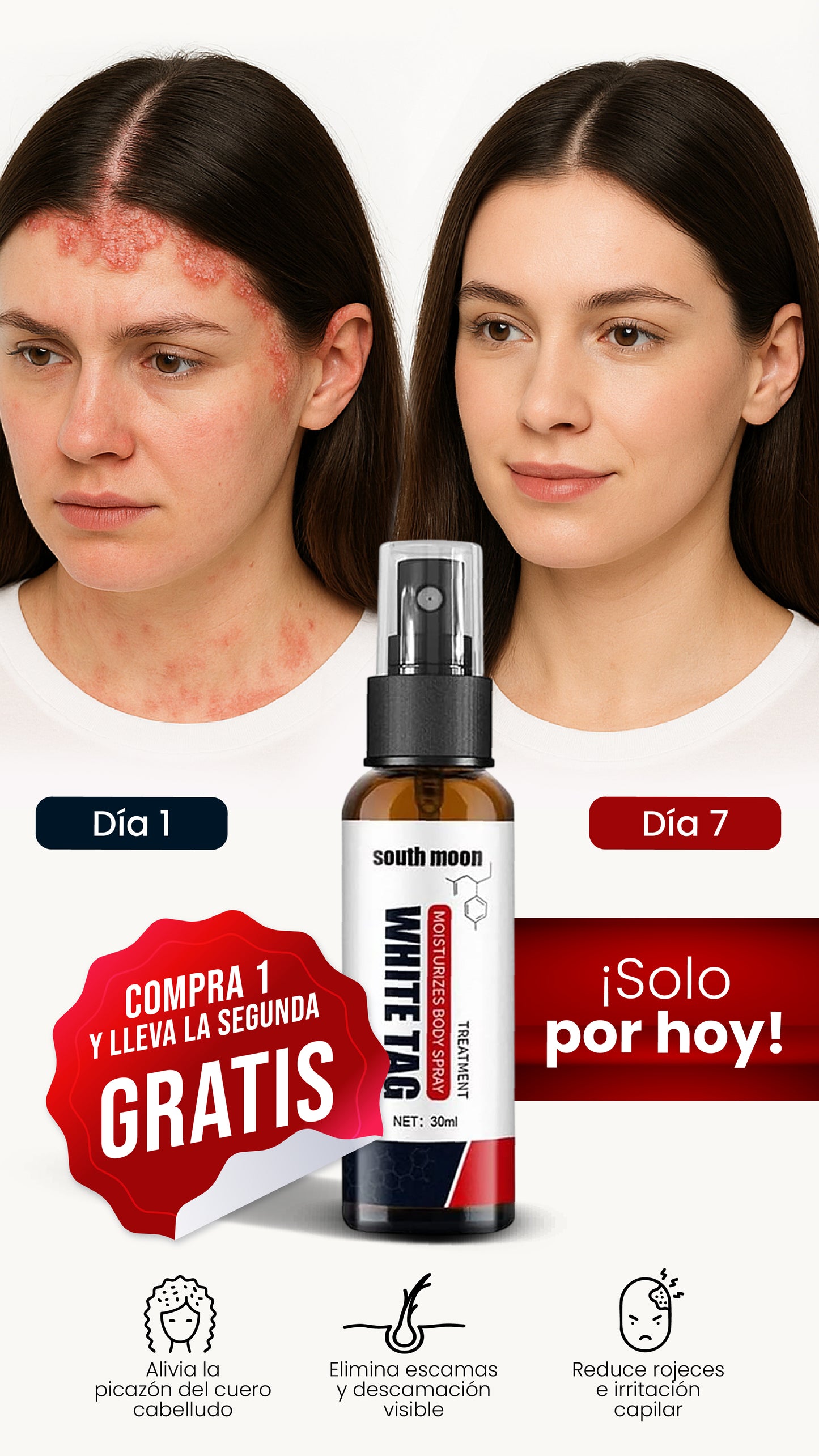 SPRAY WHITE TAG | ELIMINA LA PICAZÓN Y EL ENROJECIMIENTO