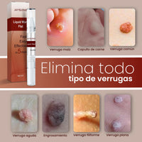 Removedor Rápido de Verrugas y Acné con Punta de Precisión - Pack 2 - 3