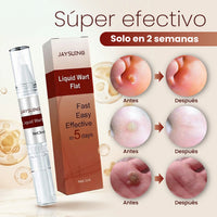 Removedor Rápido de Verrugas y Acné con Punta de Precisión - Pack 2 - 5