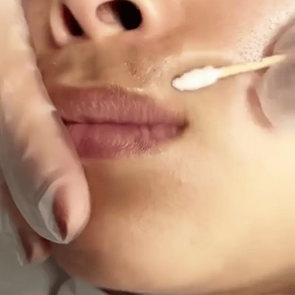 Freckle Cream |Crema Blanqueadora de Pecas y manchas