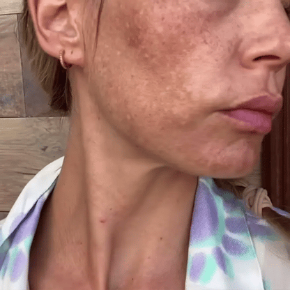 Eelhoe Retinol | Crema Blanqueadora Natural
