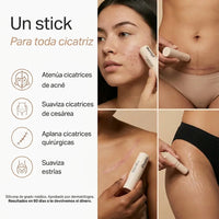 Pluune Barra de Silicona para Cicatrices: Adiós Acné, Estrías y Marcas - 3