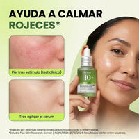 Anua Serum Ácido Azelaico 10%: Adiós Acné y Manchas para una Piel Radiante - 5