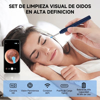 Limpiador de Oídos Inteligente con Cámara HD para Visión 360° - 5