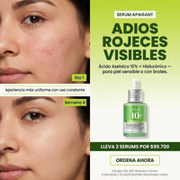 Anua Serum Ácido Azelaico 10%: Adiós Acné y Manchas para una Piel Radiante - 3