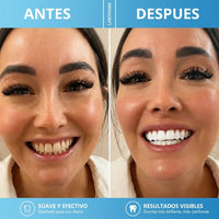 Lápiz Blanqueador Dental | Adiós Dientes Amarillos  x2 unidades - 2