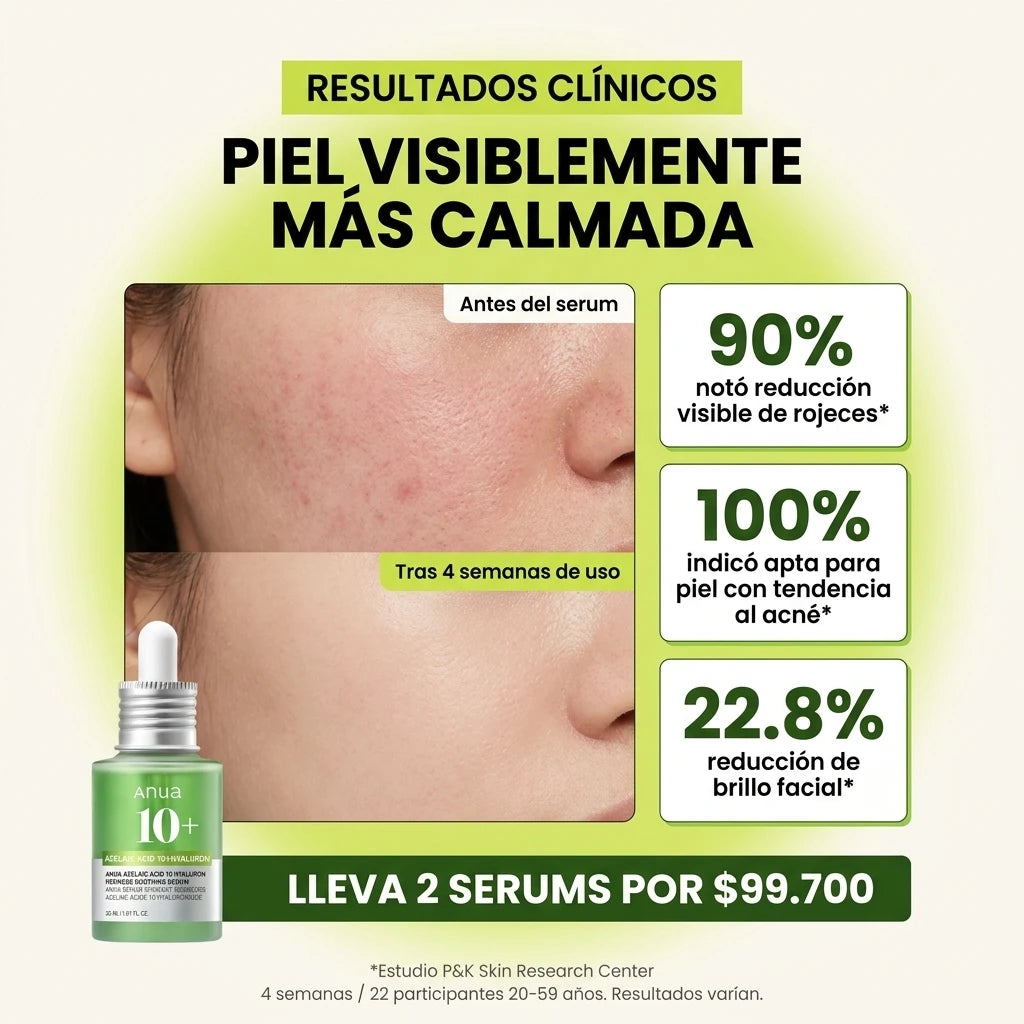 Anua Serum Ácido Azelaico 10%: Adiós Acné y Manchas para una Piel Radiante