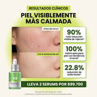 Anua Serum Ácido Azelaico 10%: Adiós Acné y Manchas para una Piel Radiante - 1