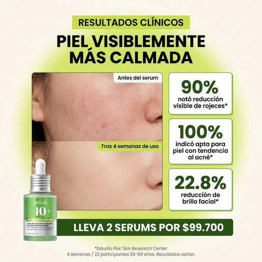 Anua Serum Ácido Azelaico 10%: Adiós Acné y Manchas para una Piel Radiante