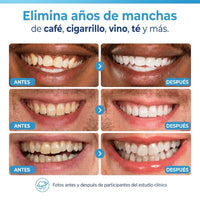 Lápiz Blanqueador Dental | Adiós Dientes Amarillos  x2 unidades - 4