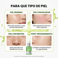 Anua Serum Ácido Azelaico 10%: Adiós Acné y Manchas para una Piel Radiante - 9