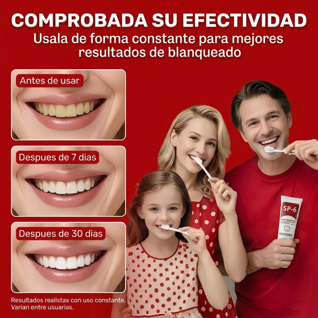 SP-6 Probiotic: Crema Dental Blanqueadora con 6 Probióticos para Sonrisa Radiante