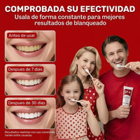 SP-6 Probiotic: Crema Dental Blanqueadora con 6 Probióticos para Sonrisa Radiante - 1