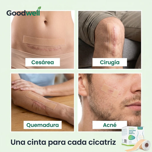 Cinta de silicona para cicatrices · zonas