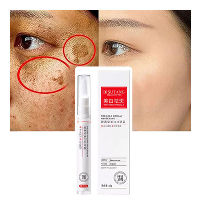 Freckle Cream |Crema Blanqueadora de Pecas y manchas