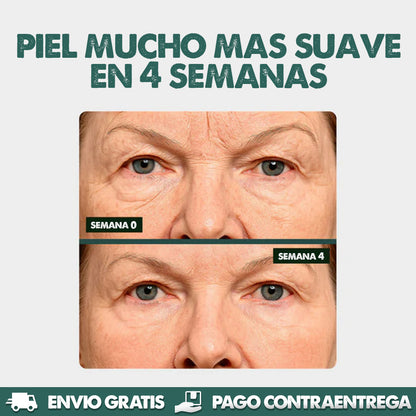 Silicone Marks Sheet | Elimina líneas de expresión