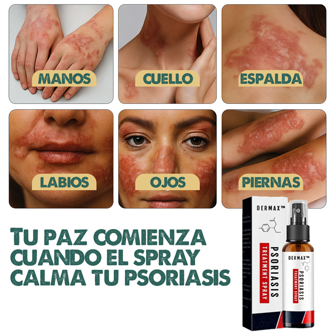 SPRAY PSORIASIS X2 UNIDADES | ALIVIO RÁPIDO DE PICAZÓN Y ARDOR