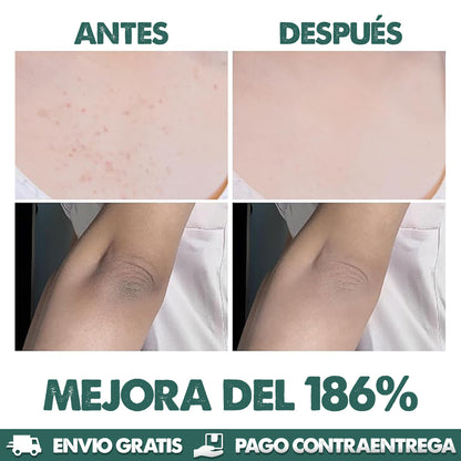 DR. MELAXIN - Aclara y unifíca el tono