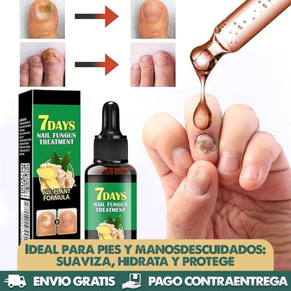 7 DAYS - UÑAS MÁS FUERTES Y SIN HONGOS