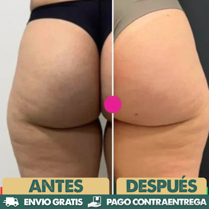 ADEUS - Adios a la celulitis y piel flácida