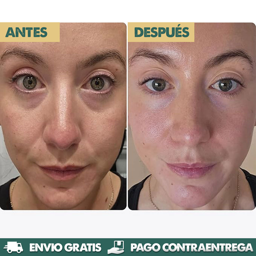 Micro-Infusion Patches - Mirada más joven y radiante