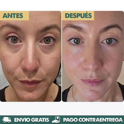 Micro-Infusion Patches - Mirada más joven y radiante