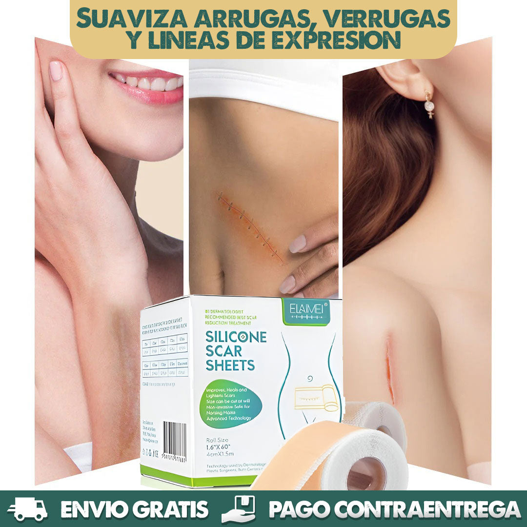 Silicone Marks Sheet | Elimina marcas en la piel en semanas