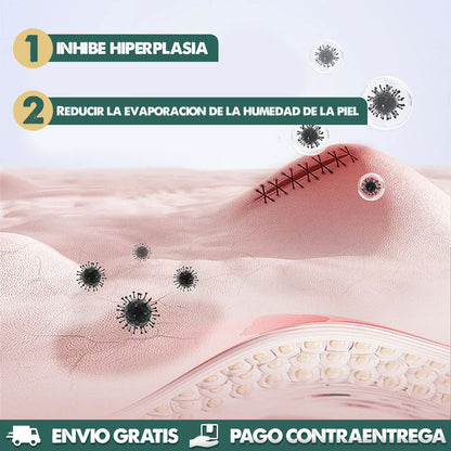 Silicone Marks Sheet | Elimina marcas en la piel en semanas