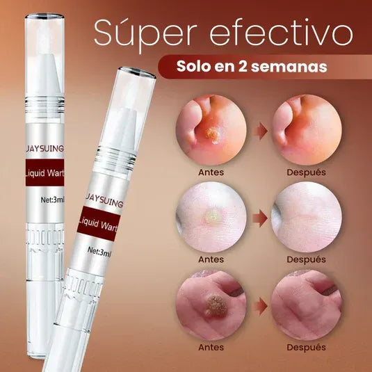 Persona activa realizando sus tareas sin dolor