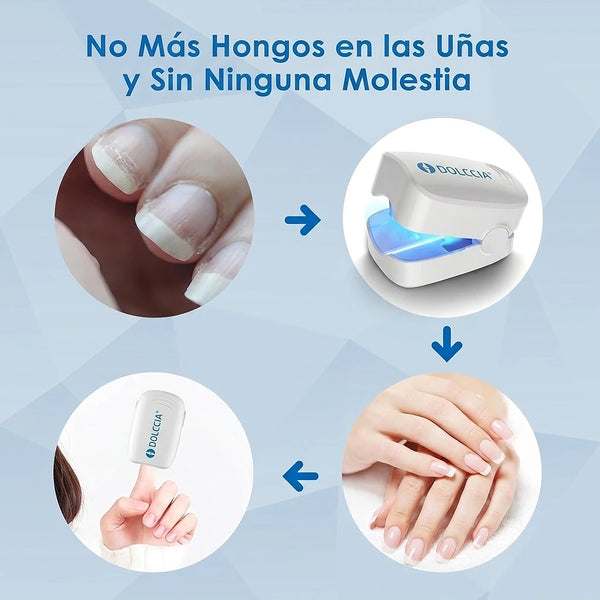 Persona frustrada mirando sus uñas sin mejora