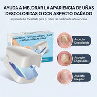 DOLCCIA® Laser de Uñas Portátil: Elimina Hongos en Casa Efectivamente - 1