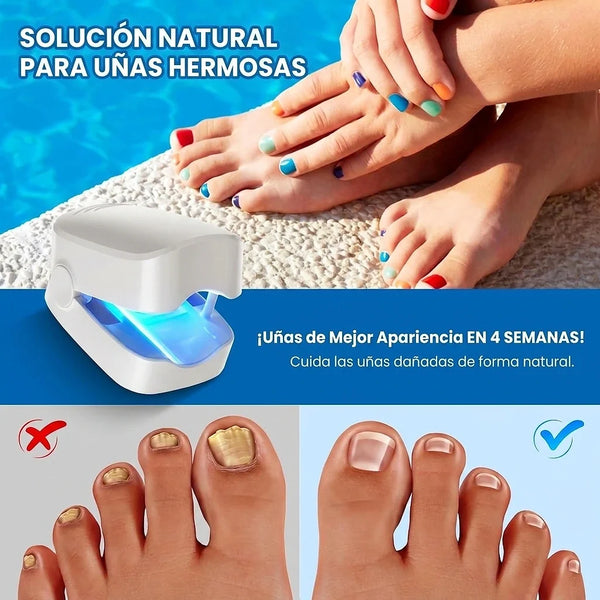 DOLCCIA — laser-hongos-1786041529300-09.webp