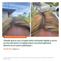 Sérum Capilar GROW:TURN con Peine Aplicador | 100 ml para el Cuero Cabelludo - 1